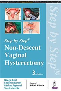 Step by Step: Non-Descent Vaginal Hysterectomy