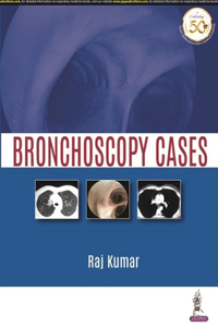 Bronchoscopy Cases