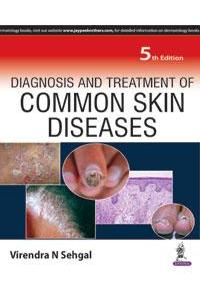 Diagnosis and Treatment of Common Skin Diseases