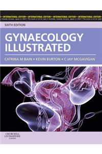 Gynaecology Illustrated