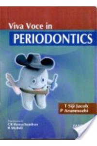 Viva Voce in Periodontics