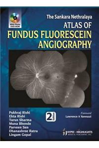 Atlas of Fundus Fluorescein Angiography