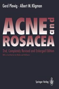 Acne and Rosacea