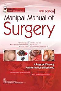 Manipal Manual of Surgery