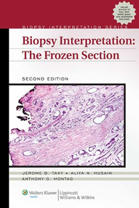 Biopsy Interpretation: The Frozen Section