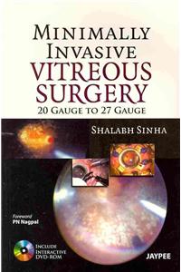 Minimally Invasive Vitreous Surgery: 20 Gauge to 27 Gauge