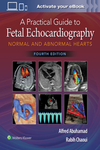 A Practical Guide to Fetal Echocardiography