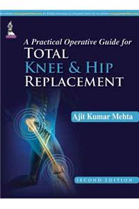 Practical Operative Guide for Total Knee and Hip Replacement