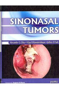 Sinonasal Tumors