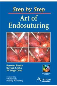 Art of Endosuturing: Step by Step