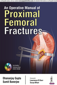 Operative Manual of Proximal Femoral Fractures