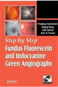 Step by Step Fundus Fluorescein and Indocyanine Green Angiography Wiht Photo CD-Rom,2007