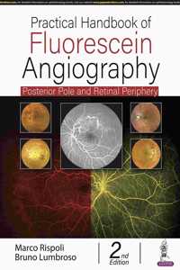 Practical Handbook of Fluorescein Angiography