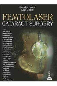 Femtolaser Cataract Surgery