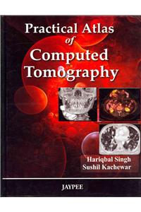 Practical Atlas of Computed Tomography