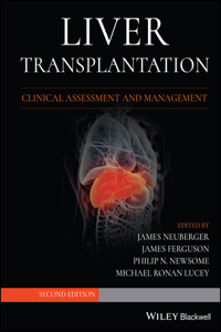 Liver Transplantation