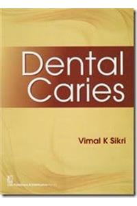 Dental Caries