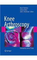 Knee Arthroscopy