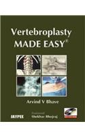 Vertebroplasty Made Easy