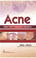 Acne Atlas with Treatment Options