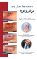 Leg Ulcer Treatment Revolution