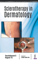 Sclerotherapy In Dermatology