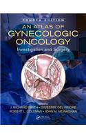 An Atlas of Gynecologic Oncology