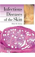 Infectious Diseases of the Skin