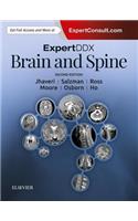 Expertddx: Brain and Spine