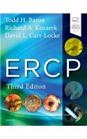 Ercp