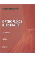 Orthopedics Illustrated