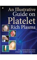 An Illustrative Guide on Platelet Rich Plasma