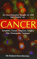 Illustrated Guide to the Treatment of Cancer