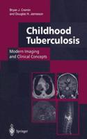 Childhood Tuberculosis: Modern Imaging and Clinical Concepts