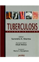 Tuberculosis