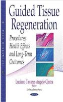 Guided Tissue Regeneration