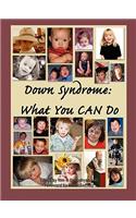 Down Syndrome