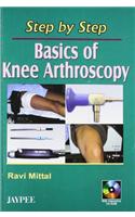 Step by Step Basics of Knee Arthroscopy with CD-ROM