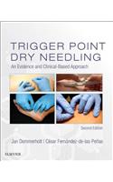 Trigger Point Dry Needling