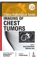 Clinico Radiological Series Imaging Of Chest Tumors