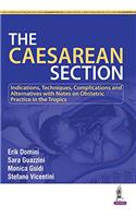 The Caesarean Section