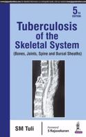 Tuberculosis of the Skeletal System