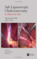 Safe Laparoscopic Cholecystectomy