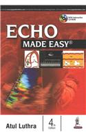 Echo Made Easy