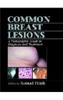 Common Breast Lesions: A Photographic Guide to Diagnosis and Treatment