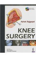 Knee Surgery