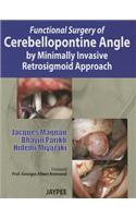 Functional Surgery of Cerebellopontine Angle by Minimally Invasive Retrosigmoid Approach