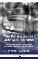 The Pathology of Dental Infections