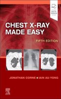 Chest X-Ray Made Easy