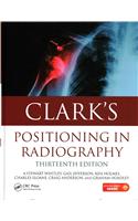 Clark's Positioning in Radiography